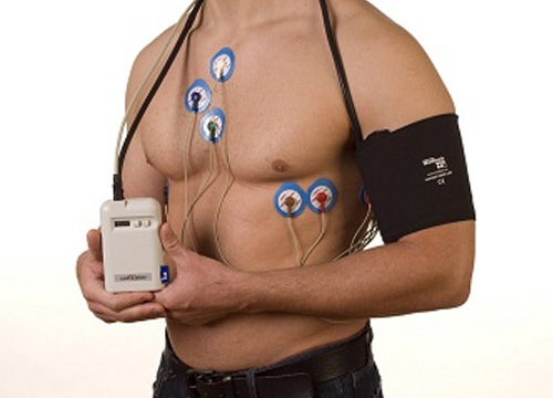Eletrocardiograma de longa duração – Holter digital 24 horas